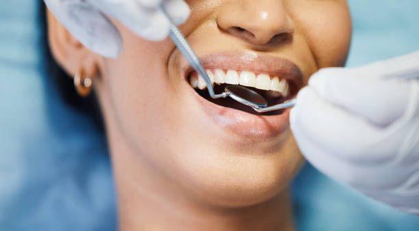 Best Dentist for Dental Trauma  in Spring Valley, WI